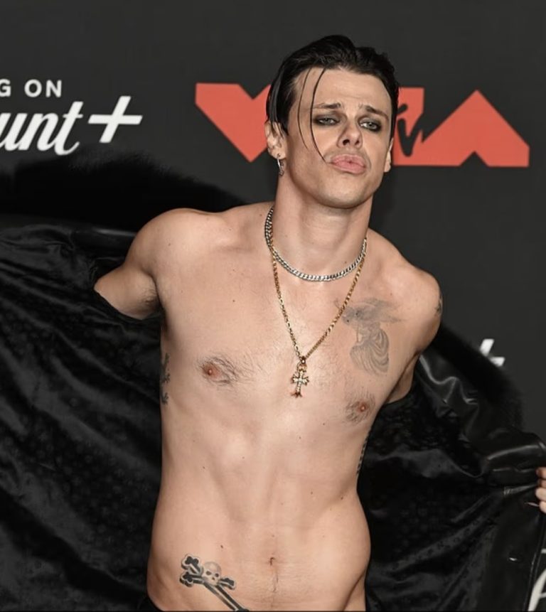 YUNGBLUD Sparks Concern With Shirtless VMAs 2025 Look